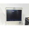 Philips CX50 Portable Ultrasound Machine