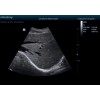Mindray DP50 Portable Ultrasound Imaging System