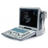 Mindray DP50 Portable Ultrasound Imaging System