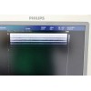 Phillips HD-9 4D3D iSlice Ultrasound